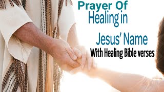 Healing Prayer With Healing Bible Verses [upl. by Eiramac]