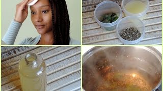 ♡Recette anti acné à la camomille  resserre les pores♡ [upl. by Tiana14]