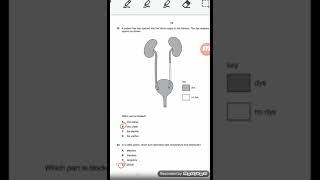 igcse biology excretion mcq past 🗞️ [upl. by Airdnahc]