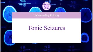 What are Tonic Seizures [upl. by Gnilrac]