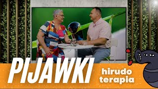 PIJAWKI w czym nam może pomóc hirudoterapia [upl. by Tremaine]