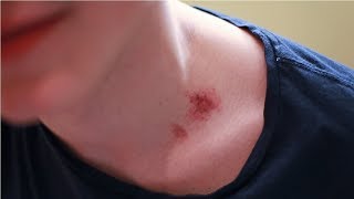 how to give a hickey fast in just 3 minutes  step by step [upl. by Nitza]