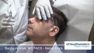 Anatomical Regional Targeted ART nerve blocks for Migraine Headaches [upl. by Siuqaj]