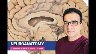 NEUROANATOMY CADAVERIC IMAGES DISCUSSION [upl. by Anire221]