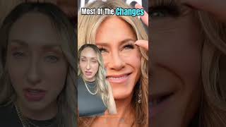 Jennifer Anniston’s face transformation shorts  celebrity jenniferaniston [upl. by Ahsoik]