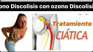 Ciatica y ozonoterapia [upl. by Yrellav]