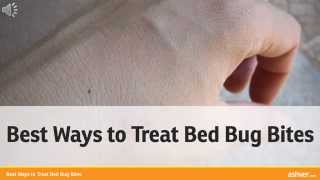 Best Ways to Treat Bed Bug Bites [upl. by Thirzi]