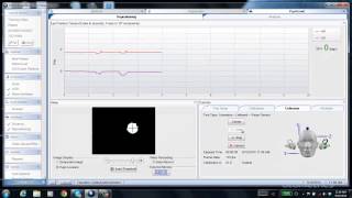 ICS Impulse  Positional Repositioning [upl. by Peggy860]