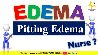 Pitting edema  Grading of pitting edema  Causes of pitting edema  Prevention of pitting edema [upl. by Ahsietal59]