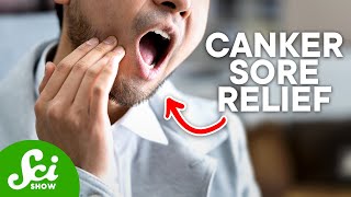 How to Get Rid of Canker Sores According to Science [upl. by Roanna897]