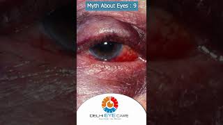 Myth 9 An Eye Injury Isn’t Serious if There’s No Pain  eyefacts eyecare delhieyecare [upl. by Penni]