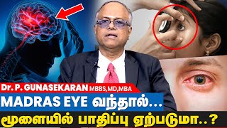 What should you do for Eye Allergy  Tamil  Dr Syed Moosa  Eye Doctor [upl. by Nierman]