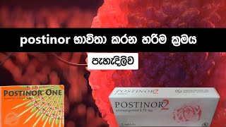 උපත් පාලනයට postinor භාවිතා කරන නිවැරදි ආකාරය 😨 How to use postinor 1 and 2 tablets sinhala [upl. by Anse]