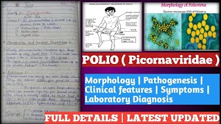 polio  poliomyelitis in hindi  polio vaccination  polio disease in hindi  polio in hindi [upl. by Enirtak]