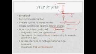 dilation and curettage  description indications and questions [upl. by Ahsar610]