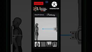 How to do Chest XRay PA view  XRay Positioning radiology xray positioning shorts chest [upl. by Oba503]