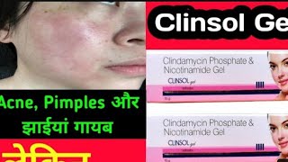 Clinsol gel review  Clinsol gel  Best pimple gel  पिंपल्स के लिए सबसे बेस्ट जेल  क्लिंसोल जेल [upl. by Nivahb933]