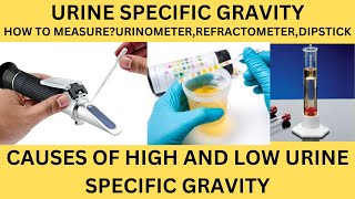 URINE SPECIFIC GRAVITYHOW TO MEASURECAUSES OF HIGH AND LOW SPECIFIC GRAVITYURINE ROUTINE [upl. by Roderica]