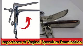 Importance of Vaginal Speculum Examination♀️ [upl. by Reiko]