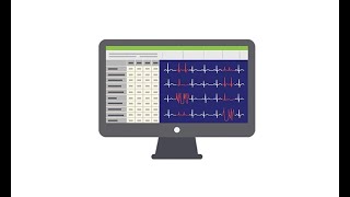 Reviewing the ECG of the Holter monitor [upl. by Ennahgem]