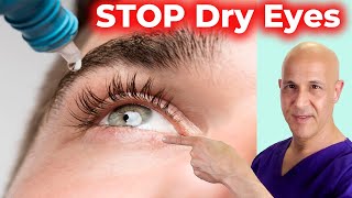 Soothe and Heal DRY EYES Naturally Dr Mandell [upl. by Bevus]