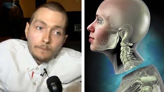 What Happened To The First Human Head Transplant Feat Medlife Crisis [upl. by Nauqad824]