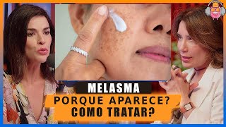 A Melhor explicação sobre Mancha no Rosto de MELASMA como aparece e como tratar [upl. by Tiram]