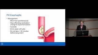 Common Disorders of the Esophagus and Stomach  Conference Preview [upl. by Anitra]