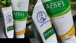 Acnes scar care gel and Acnes Fairness face wash by Mentholatum Reviewworth or not🤔 [upl. by Akenal90]