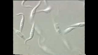 Trypanosoma [upl. by Dinesh298]