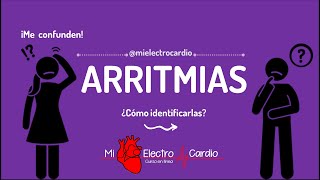 ARRITMIAS CARDÍACAS  GUÍA  MIELECTROCARDIO [upl. by Benny847]