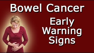 Early Warning Signs Of Bowel Cancer [upl. by Nalced]