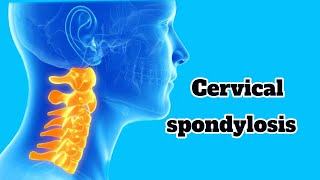 CERVICAL SPONDYLOSIS IN TAMIL CAUSES PATHOPHYSIOLOGY CLINICAL FEATURESINVESTIGATION  TREATMENT [upl. by Arba]