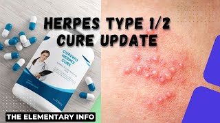 Herpes type 12 Cure Update  The Elementary Info [upl. by Corwun]