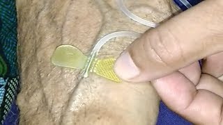 emergency Phlebotomy with 21G Butterfly Needle  drtusarofficial [upl. by Radcliffe450]