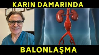 Karın Damarında Balonlaşma Abdominal Aort AnevrizmasıSerdar Akgün [upl. by Zavala574]