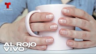 Conoce estos 10 aspectos de tus uñas que pueden indicar enfermedades [upl. by Acimahs]