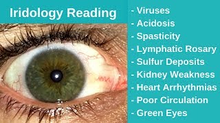 Iridology Reading  Viruses and Acidosis [upl. by Omlesna219]