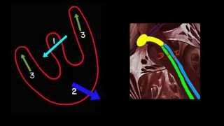 CURSO DE ELECTROCARDIOGRAFIA 43  BLOQUEO DE RAMA DERECHA [upl. by Ide]