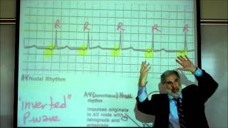 CARDIAC PHYSIOLOGY PART 3 by Professor Finkwmv [upl. by Yrrep45]