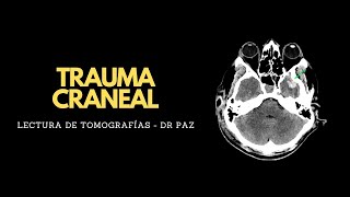 Lecturas tomográficas  Trauma Craneal [upl. by Surazal]