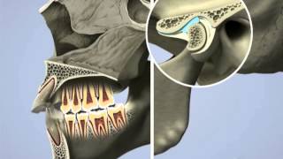 Airway and TMJ English [upl. by Attalie943]