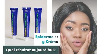 Mon avis sur épiderme 30g aujourdhui comment choisir sa crème de visage🙄🙄 [upl. by Kiki]