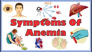 Common Signs amp Symptoms Of Anemia Iron Deficiency Hemolytic amp Other Anemias  Anemia Symptoms [upl. by Norty]