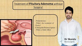 Pituitary Adenoma  Non Surgical treatment Cure without Operation Prolactinoma By Dr SkandaNSx [upl. by Duke]