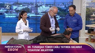 Hacamat Nasıl Yapılır Canlı Yayında Hacamat Tedavisi [upl. by Jallier]