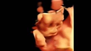 Chison Qbit 4D Virtual HD four Dimensional image of baby Fetal ultrasound [upl. by Arelus]