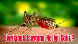 SİVRİSİNEK ISIRIĞINA NE İYİ GELİR  SİVRİSİNEK ISIRMASI  SİVRİSİNEK ISIRIĞI NASIL GEÇER [upl. by Etteoj303]