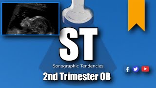 2nd Trimester OB scan [upl. by Yrac]