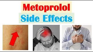 Metoprolol amp Beta Blockers Side Effects amp Why They Occur [upl. by Laith]